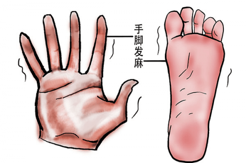 手腳經(jīng)常發(fā)麻是什么原因?手腳發(fā)麻可能患有哪些疾病？